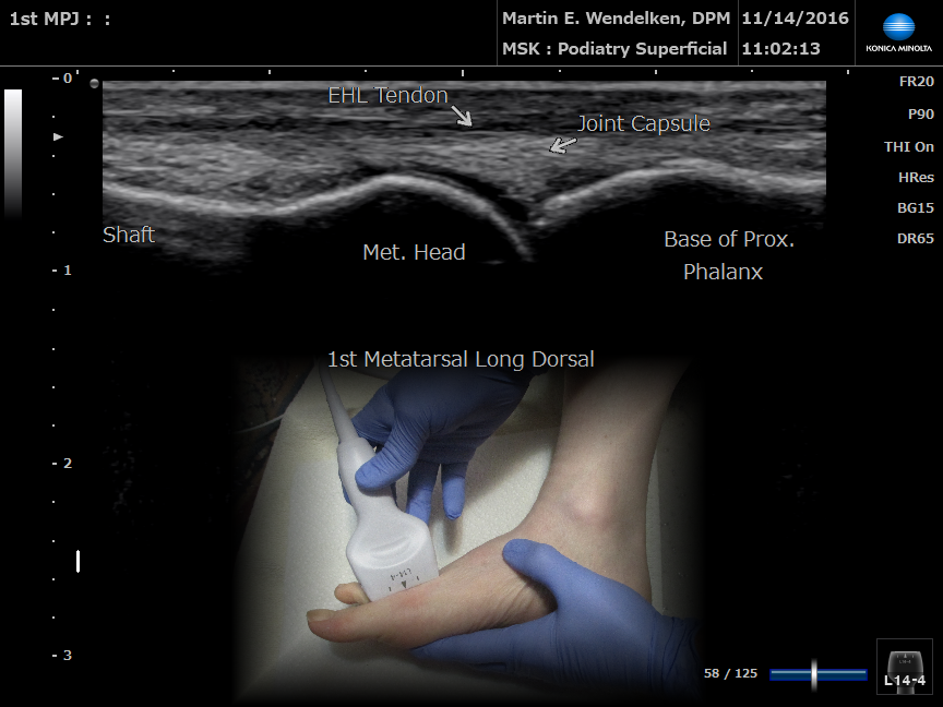 Best in-class Imaging Ultrasound System for Podiatrists - Sonimage HS2